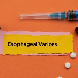 1-day on par with 5-day octreotide in preventing bleeding, death from esophageal varices