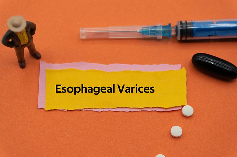 1-day on par with 5-day octreotide in preventing bleeding, death from esophageal varices