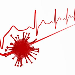 Lower limb deep vein thrombosis common in COVID-19