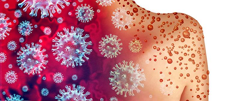 MVA-BN vax shows favourable safety, tolerability in adolescents in phase II study