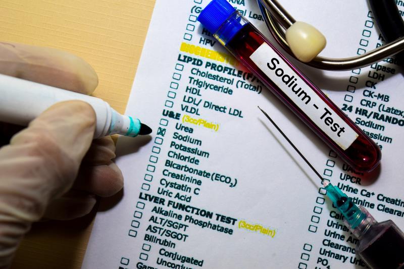 Abnormal blood sodium levels may indicate COVID-19 severity