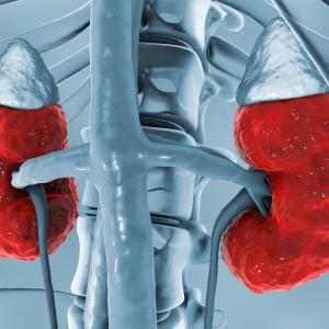 Acute kidney injury more prevalent among patients on antibiotic combo vs monotherapy