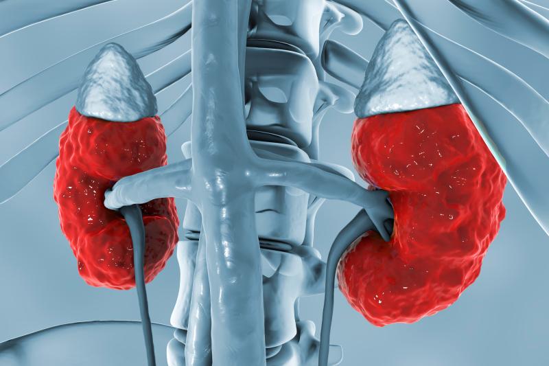 Acute kidney injury more prevalent among patients on antibiotic combo vs monotherapy