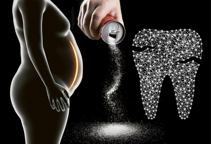 Acids, sugar: The ties that bind obesity and tooth wear?