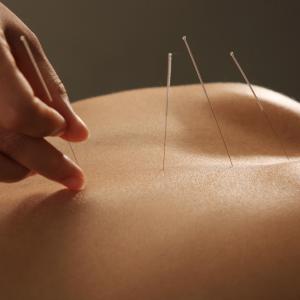 Acupuncture, massage equally effective for cancer pain