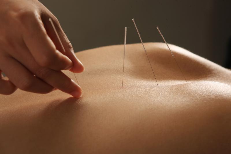 Acupuncture, massage equally effective for cancer pain