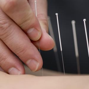 Acupuncture eases anxiety in patients with Parkinson’s disease