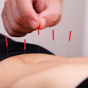 Frequent acupuncture visits tied to poor subjective health