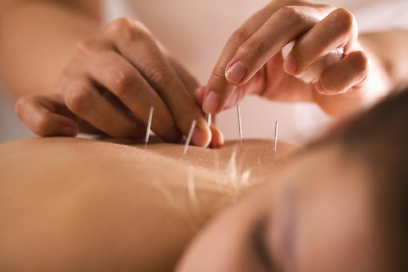 Acupuncture bests pharmacotherapy for relieving depression, anxiety in FGID patients