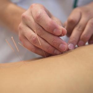 Laser moxibustion eases pain, improves function in knee OA