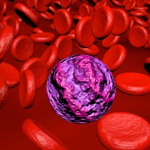 Outpatient initiation of venetoclax safe, feasible in acute myeloid leukaemia