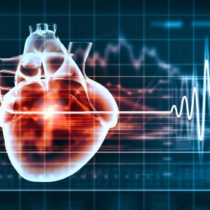 Noncardiac surgery after stenting ups myocardial infarction risk in ACS, SAP patients