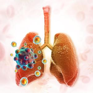 Adagrasib promising in KRASG12C-mutated NSCLC