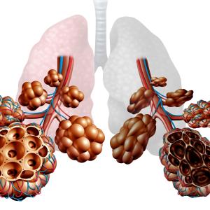 Add-on dupilumab cuts exacerbations in patients with COPD, type 2 inflammation