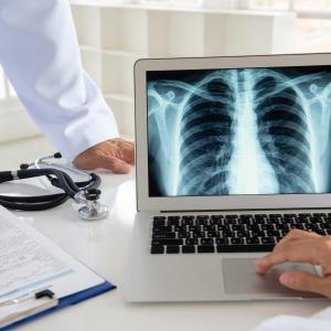 Adding canakinumab to SoC confers no survival benefit in advanced NSCLC