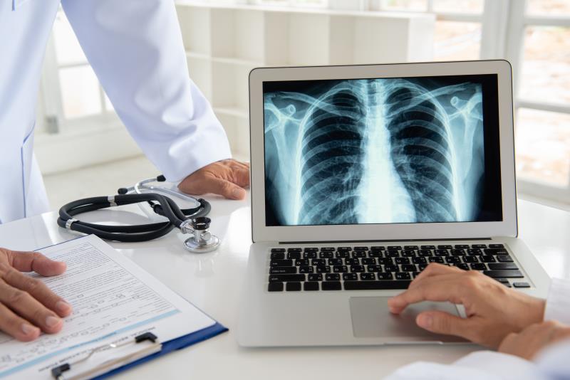 Adding canakinumab to SoC confers no survival benefit in advanced NSCLC