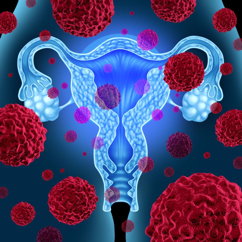 Adding trastuzumab to chemo improves survival in HER2+ uterine serous carcinoma