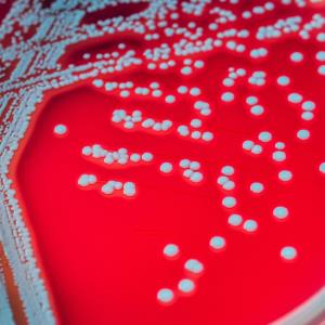 Early oral antibiotic switch a good alternative to prolonged IV treatment in gram-negative bacteraemia