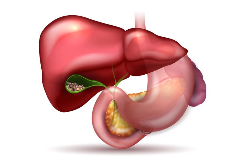 Adjuvant chemo confers no survival advantage following biliary tract cancer resection