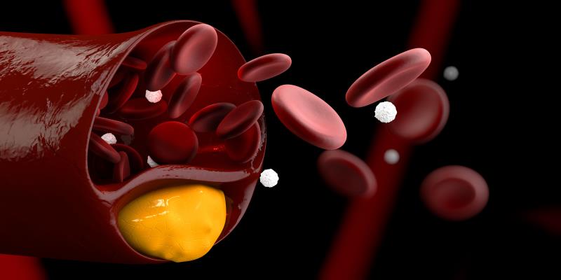 Add-on recaticimab cuts bad cholesterol in non-FH, mixed hyperlipidaemia patients