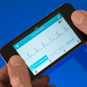 Machine-learning algorithm detects diabetes class from ECG