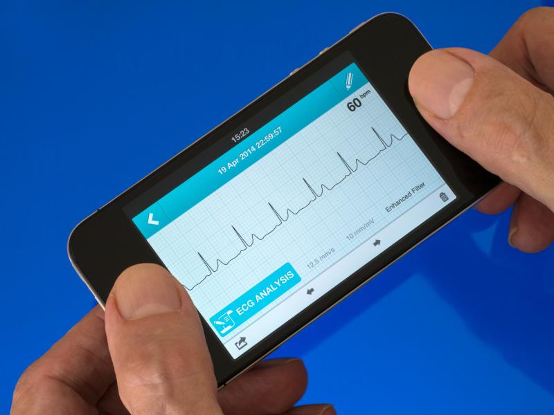 AI-based single-lead ECG monitor improves AF recurrence detection, anticoagulation adherence