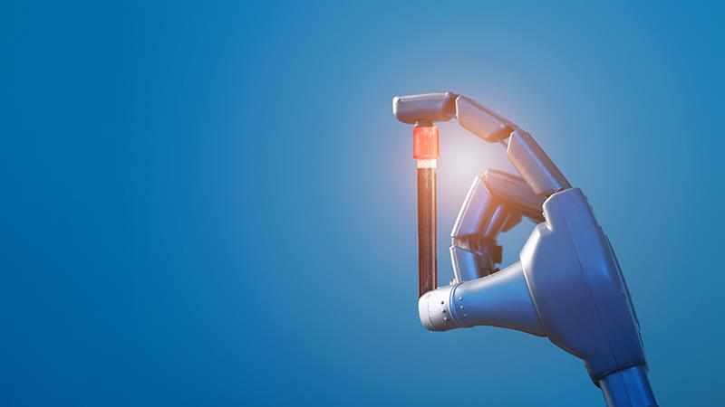 AI helps spot HCC sooner