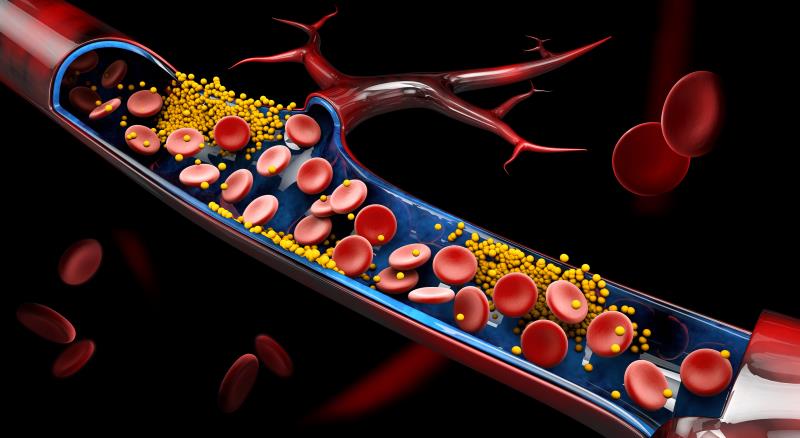 Alirocumab shows LDL-C-lowering potential in homozygous FH