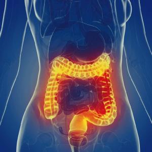 A ray of light for patients with inflammatory bowel disease: Vedolizumab success story in a patient with ulcerative colitis