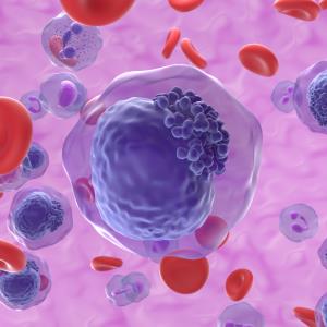 IVO-AZA combo therapy boosts OS in IDH1-mutated AML