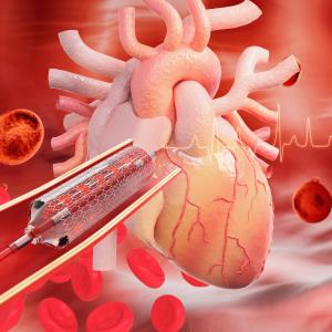 Amphilimus- vs zotarolimus-eluting stents: Any preference in patients with diabetes?