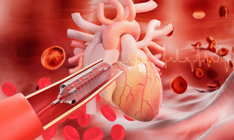 Amphilimus- vs zotarolimus-eluting stents: Any preference in patients with diabetes?