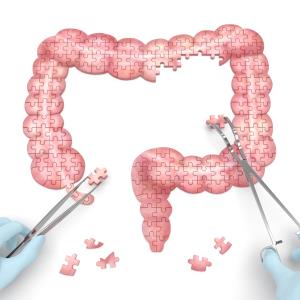 Anti-TNF exposure may increase BMI in children with Crohn’s disease