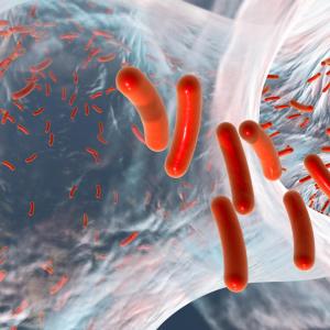 Prior carbapenem exposure ups risk of drug-resistant Pseudomonas aeruginosa infection