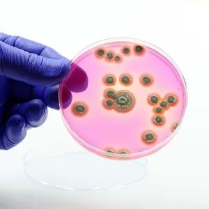 Antifungal susceptibility trends in Candida species in local setting worrying
