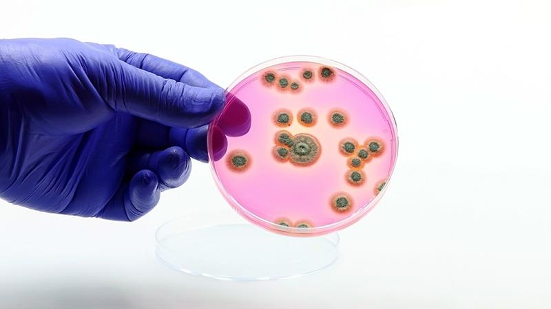 Antifungal susceptibility trends in Candida species in local setting worrying