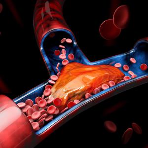 Apixaban a thromboprophylactic alternative after surgery for GYN cancers?