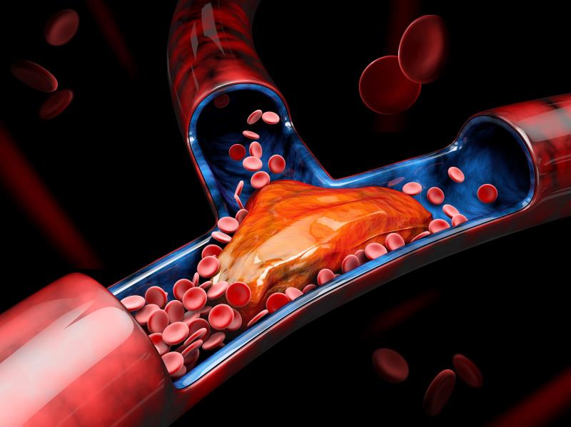 Apixaban a thromboprophylactic alternative after surgery for GYN cancers?