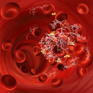 Apixaban may confer survival benefit for COVID-19 inpatients