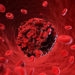 DOACs superior to warfarin for prevention of VTE recurrence in cancer patients