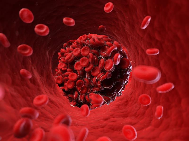 DOACs superior to warfarin for prevention of VTE recurrence in cancer patients