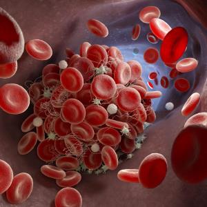 Oral anticoagulant therapy for acute VTE in obese patients