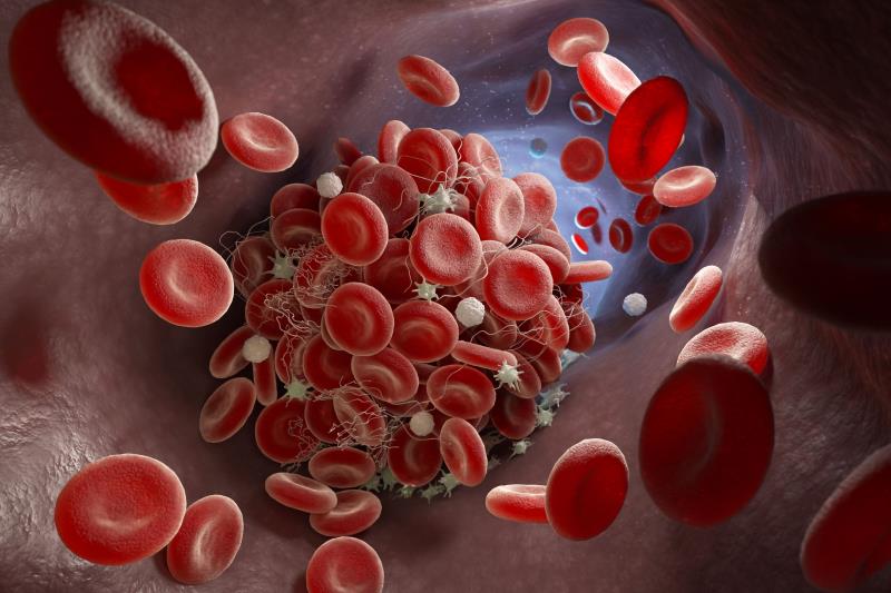 Oral anticoagulant therapy for acute VTE in obese patients