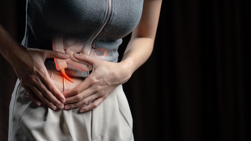 Appendicolith ups appendectomy risk after antibiotic treatment for acute appendicitis