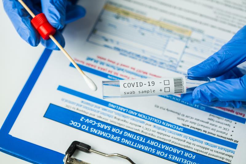 SARS-CoV-2 antigen tests exhibit moderate-to-high sensitivity vs RT-PCR, cultures