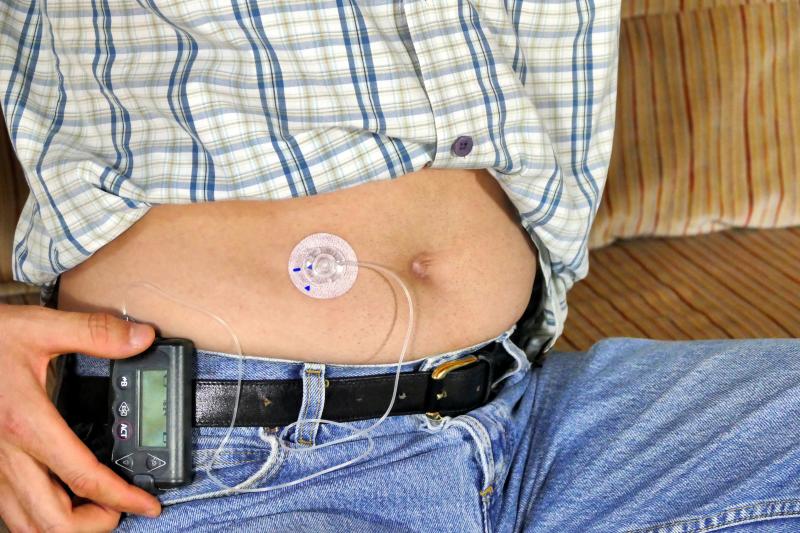 Artificial pancreas yields good results in type 2 diabetes patients