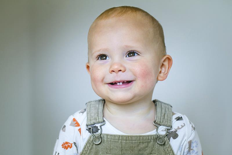 As-needed ruxolitinib in children with AD: Disease control stable through 52 weeks