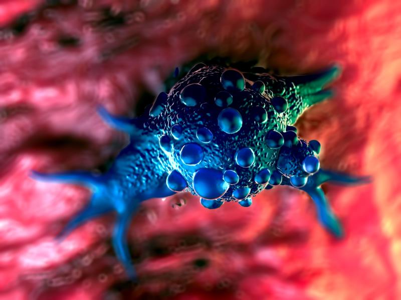 Avelumab continues to show promise for bladder cancer