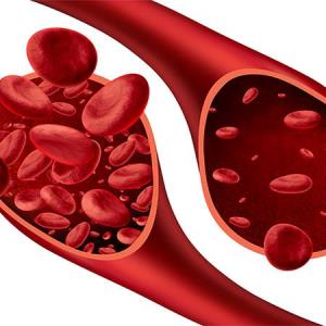 Iptacopan delivers durable responses in anti-C5-treated PNH patients with anaemia