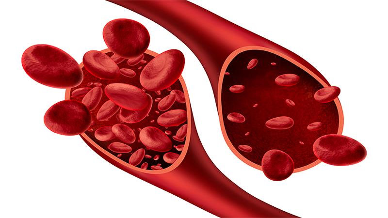 Iptacopan delivers durable responses in anti-C5-treated PNH patients with anaemia